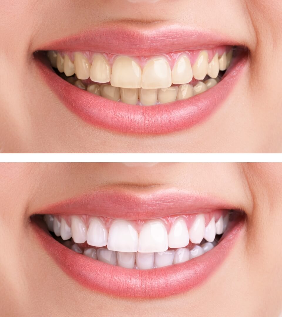 de dents - Laser Médic Spa | Clinique Esthétique |